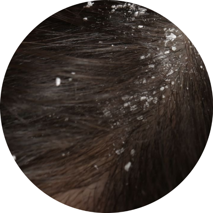 Hair & Scalp Treatment