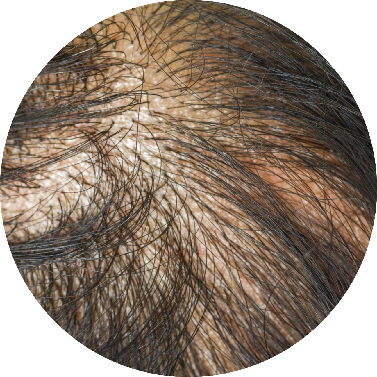 Hair & Scalp Treatment