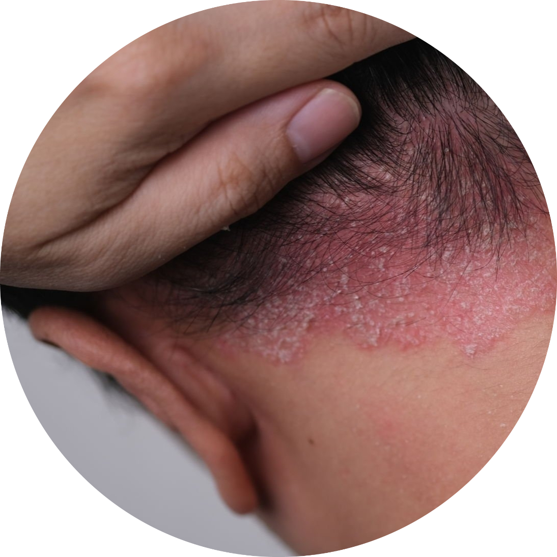 Hair & Scalp Treatment